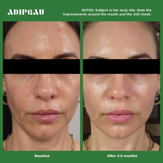 ADIPEAU - Volume Cream (2 oz)