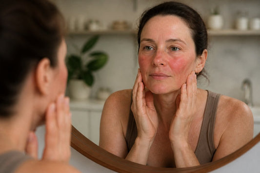 How to Treat Rosacea Redness Safely: A Step-by-Step Guide
