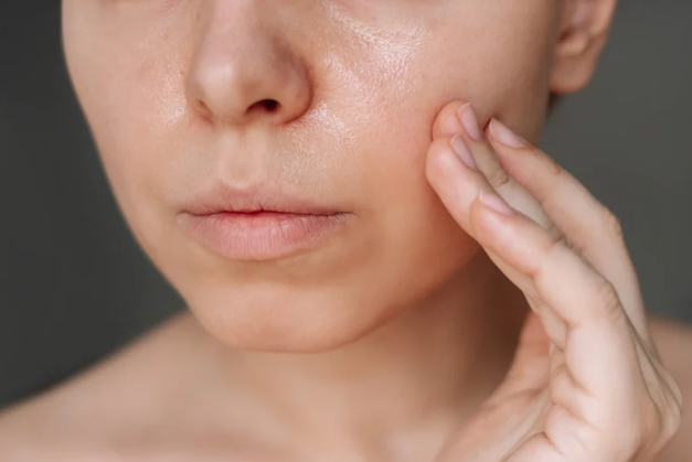 Oily Skin