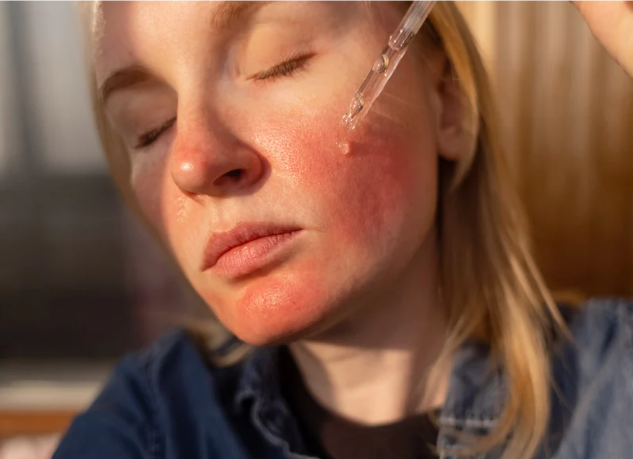Sensitive Skin