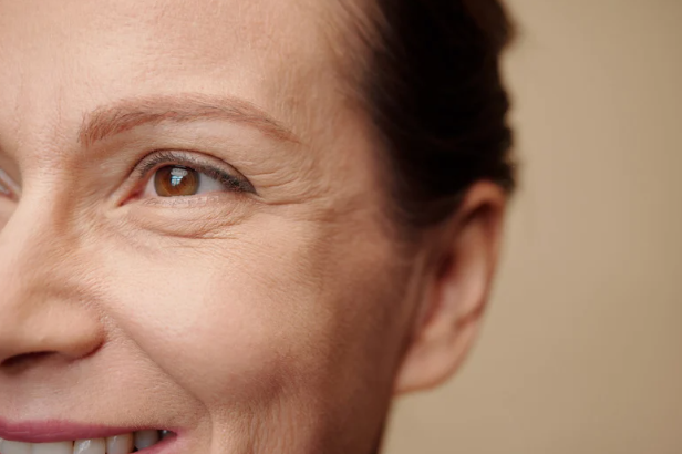 Wrinkles/Fine Lines