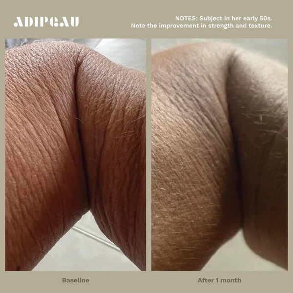 ADIPEAU - Strength Gel (5 oz)