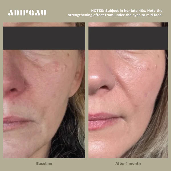 ADIPEAU - Strength Gel (5 oz)