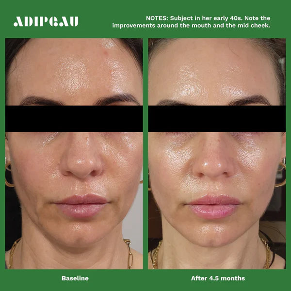 ADIPEAU - Volume Cream (2 oz)