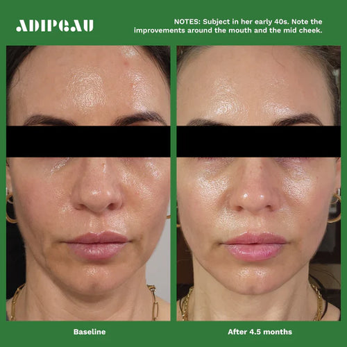 ADIPEAU - Volume Cream (2 oz)