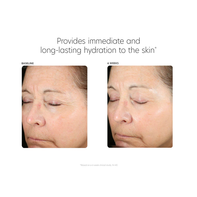 PCA SKIN - Hyaluronic Acid Boosting Serum (1 oz)