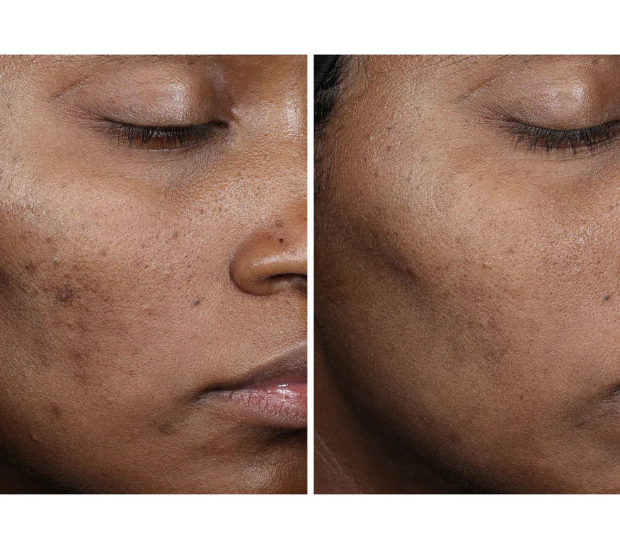 OURSELF - Complexion Brightening Serum (30 ml)