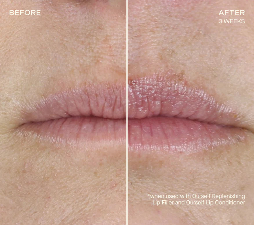 OURSELF - Replenishing Lip Filler Refill with Tiered-Release Vesicle Delivery Technology™ (2  cartridges)