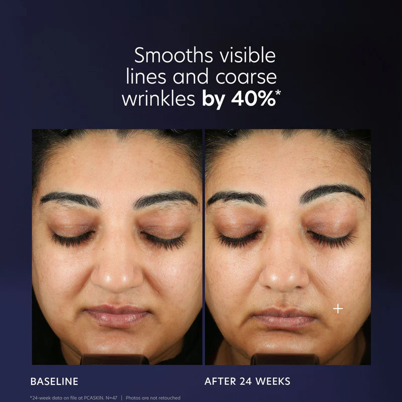 PCA SKIN - Pro-Max Age Renewal (1 oz)