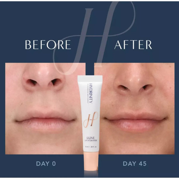 Hydrinity - LUXE Lip Hydrator - The perfect pair: Replenishing Lip Filler to build volume and shine and Lip Conditioner to moisturize and nourish lips. 