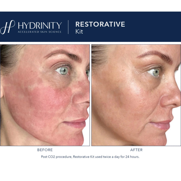 Hydrinity - Restorative Kit - Achieve skin-renewing hydration to the power of infinity with our super soothing and restorative dynamic duo. Just two simple steps to completely comfortable, revitalized, and healthier-looking skin.
