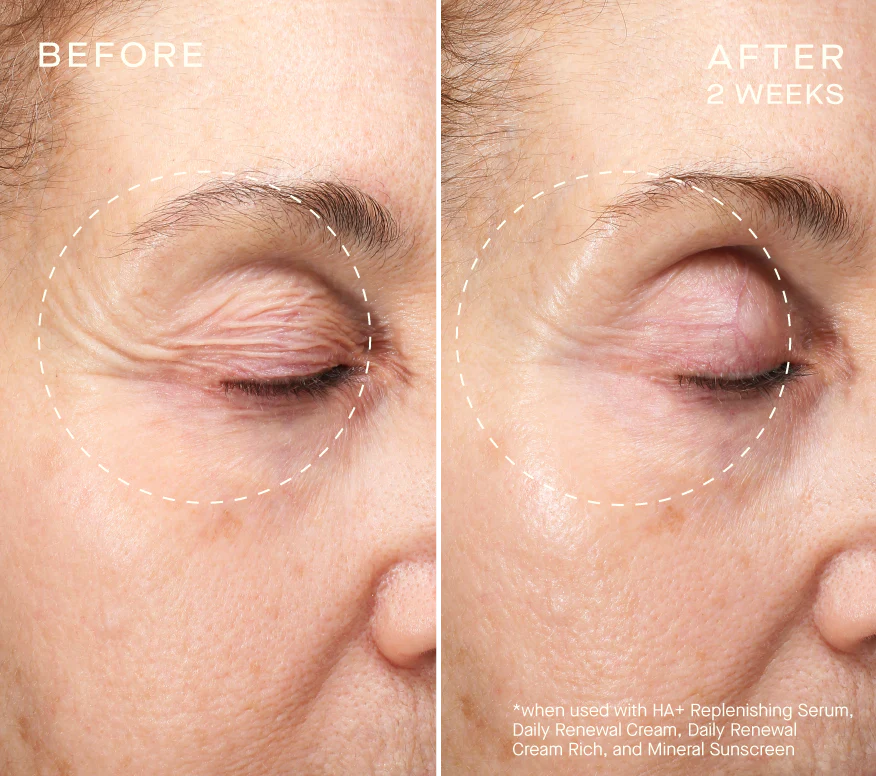 OURSELF - Volume Recovery Set
