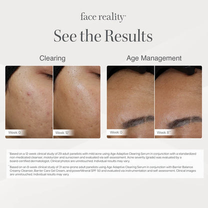 Face Reality - Age Adaptive Clearing Serum (1 oz)