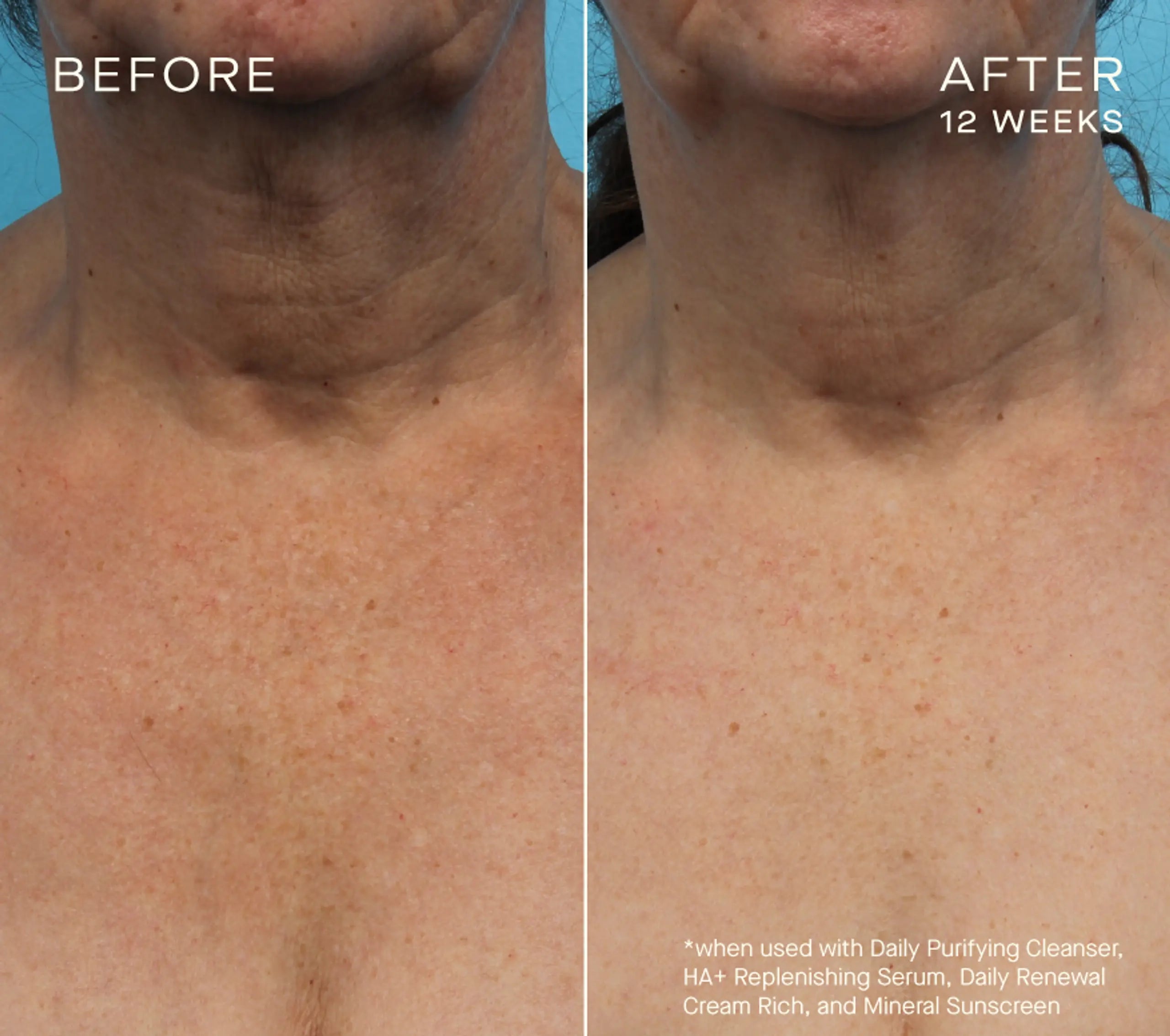 OURSELF - Advanced Regenerative Serum (15mL)