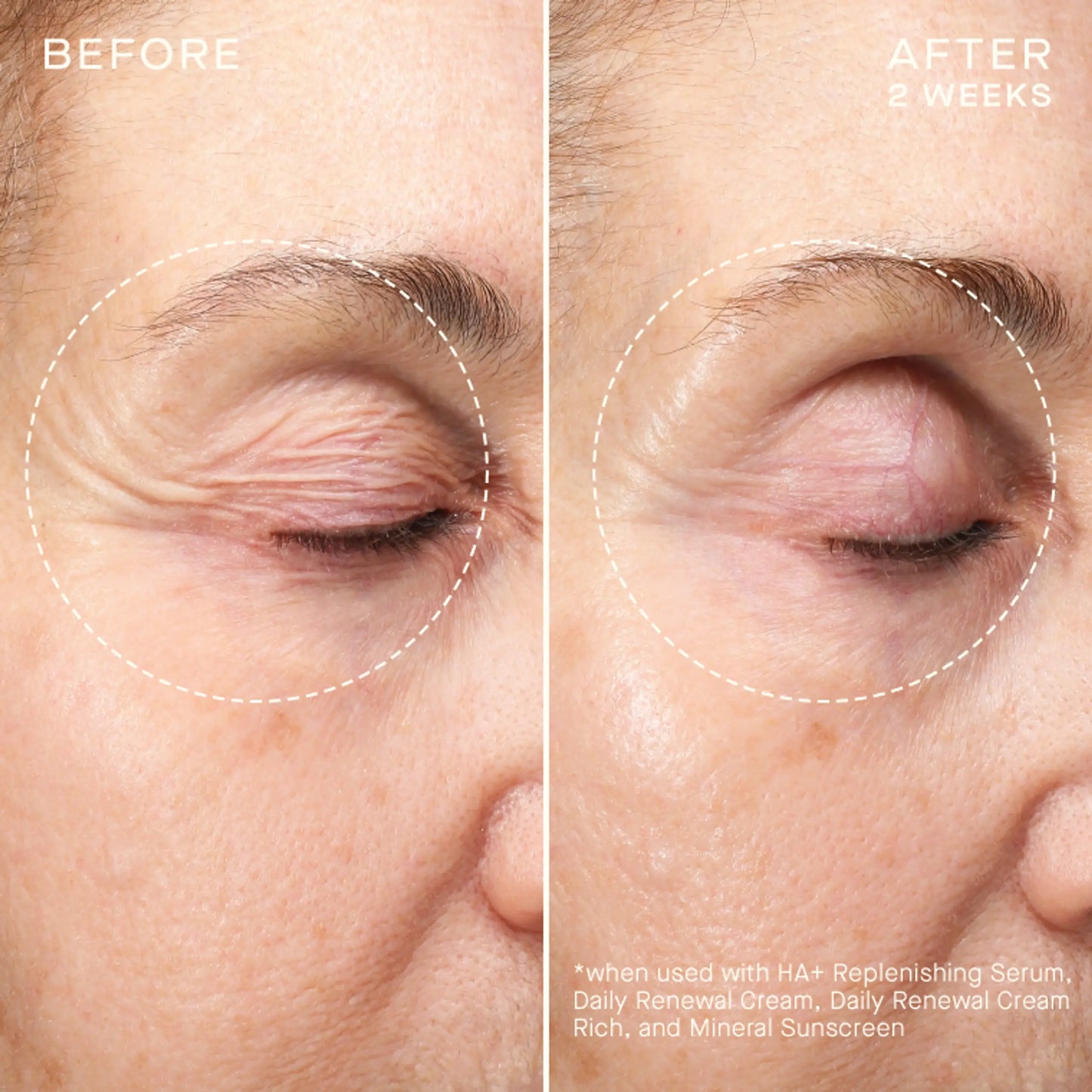 OURSELF - Advanced Regenerative Serum (30 ml & 15 ml)