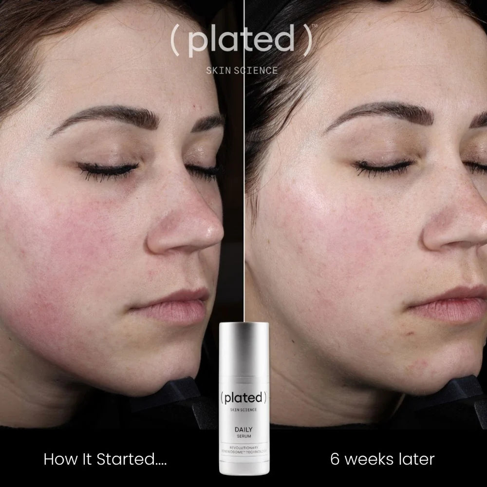 PLATED - DAILY Serum (30ml)