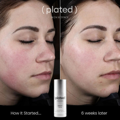 PLATED - DAILY Serum (30ml)