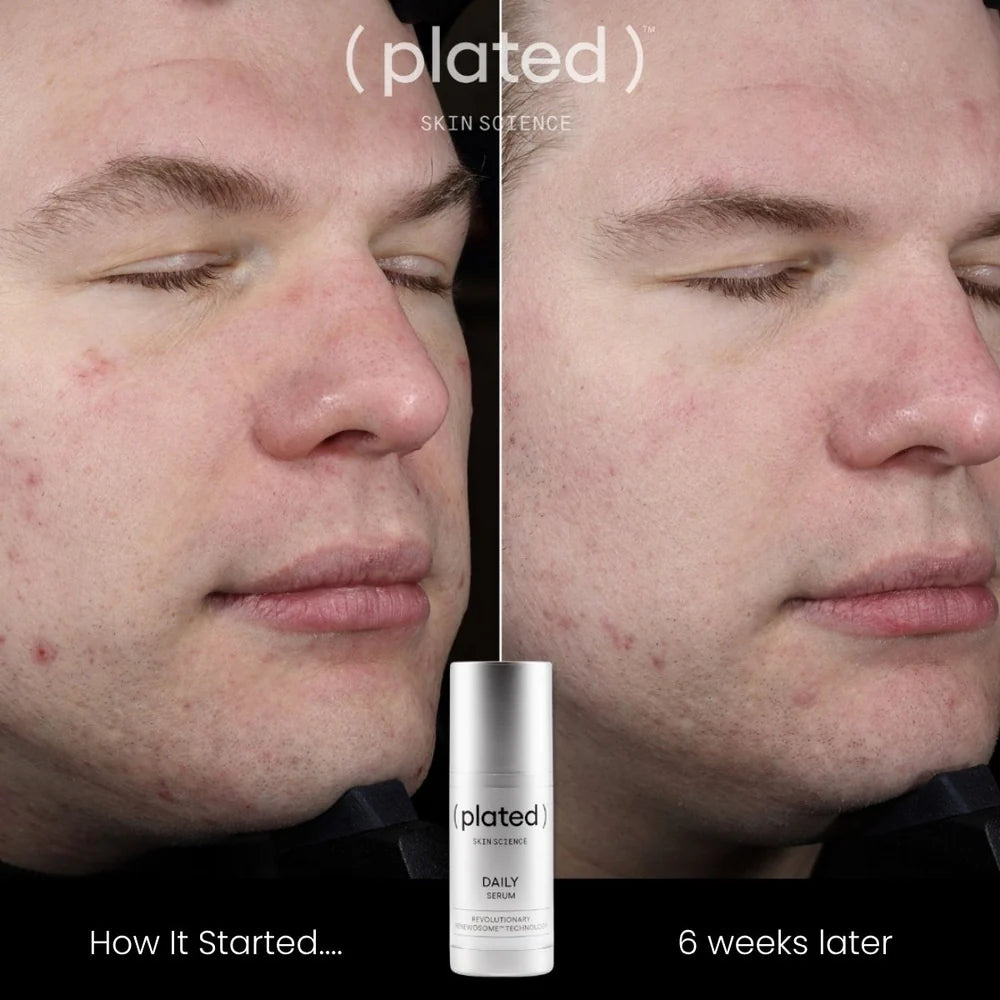 PLATED - DAILY Serum (30ml)