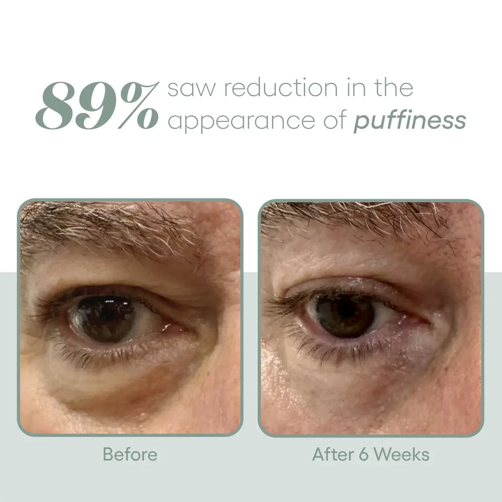 PLATED - EYE Serum (8ml)