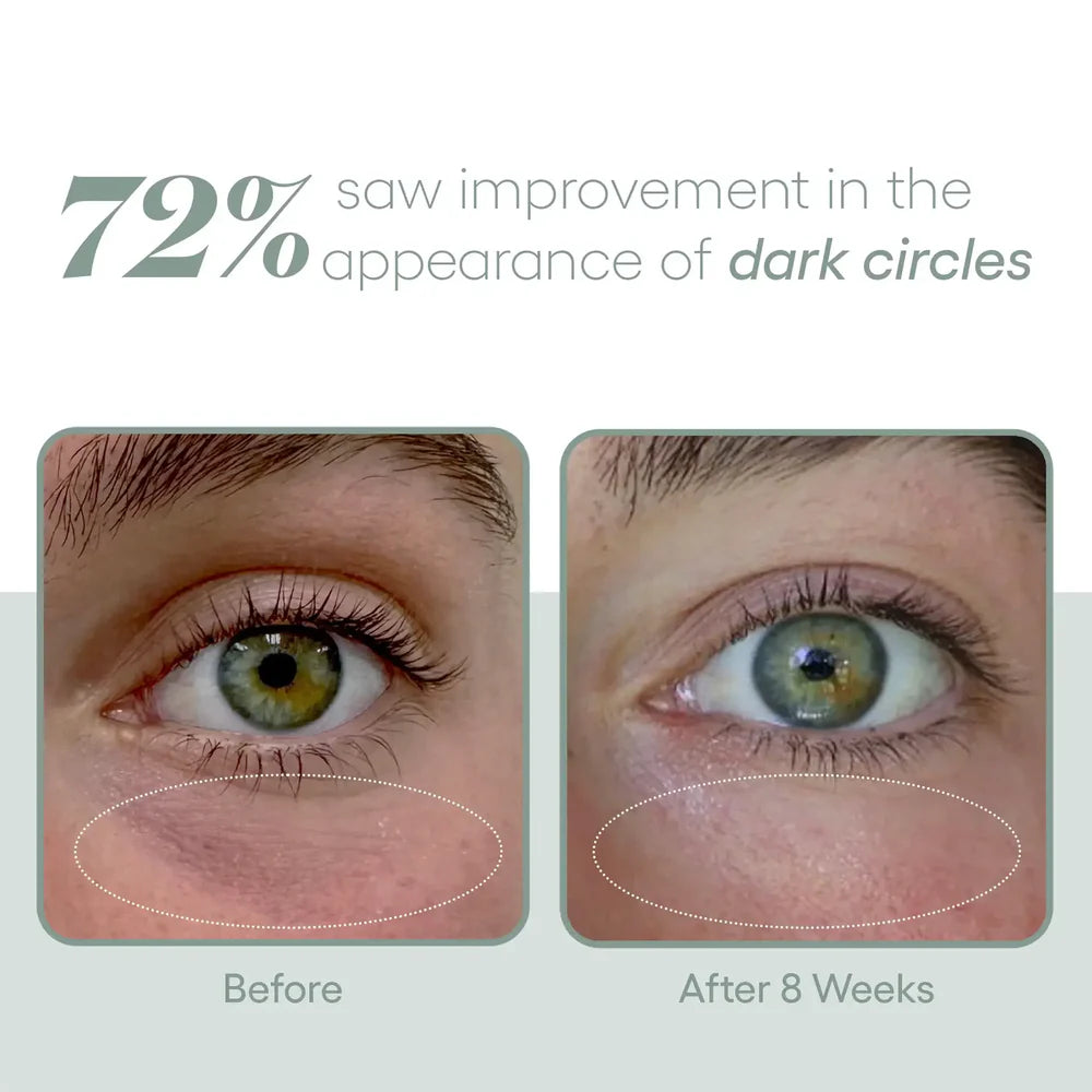 PLATED - EYE Serum (8ml)