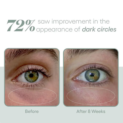 PLATED - EYE Serum (8ml)