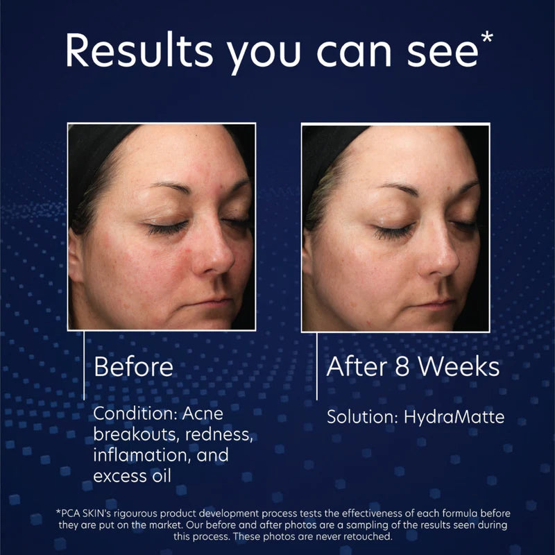 PCA SKIN - HydraMatte (1.8 oz)