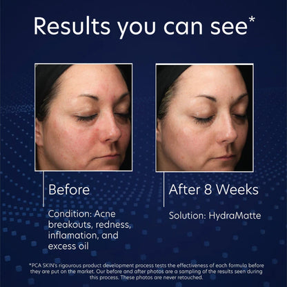 PCA SKIN - HydraMatte (1.8 oz)