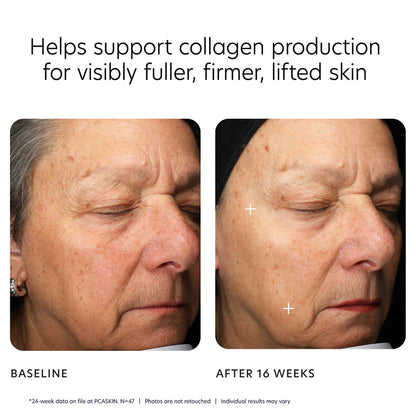 PCA SKIN - MGF Age Renewal Cream (1.8 oz) - Available in Deluxe Travel Size