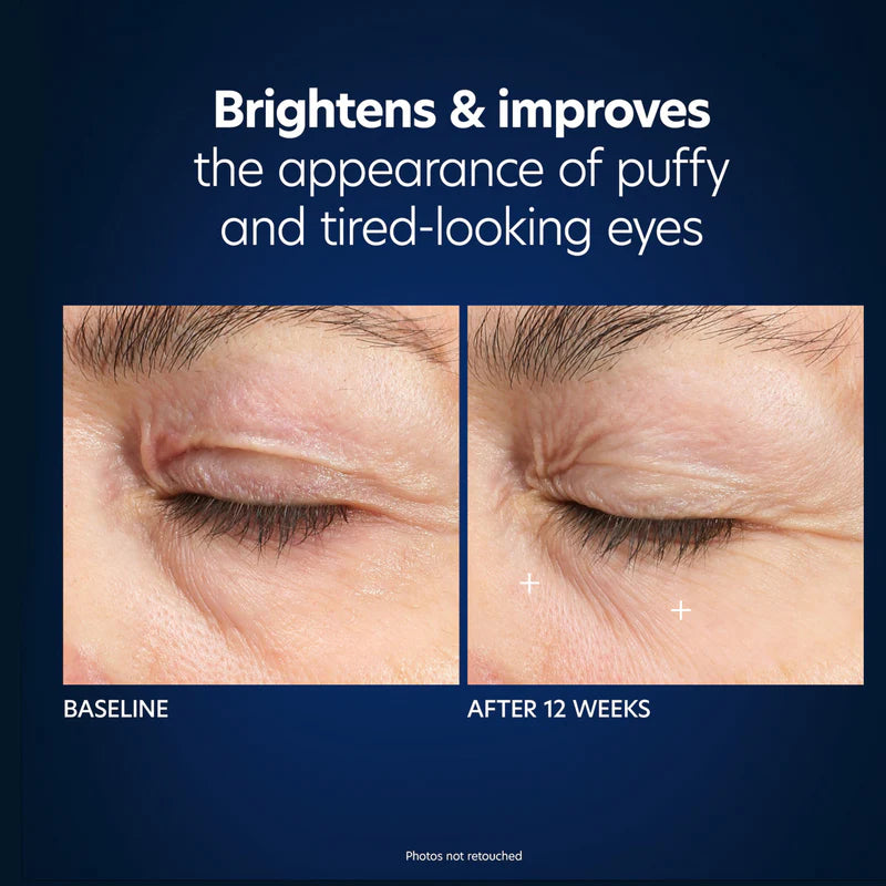 PCA SKIN - Hyaluronic Acid Microneedle Eye Patches (4 Treatments)