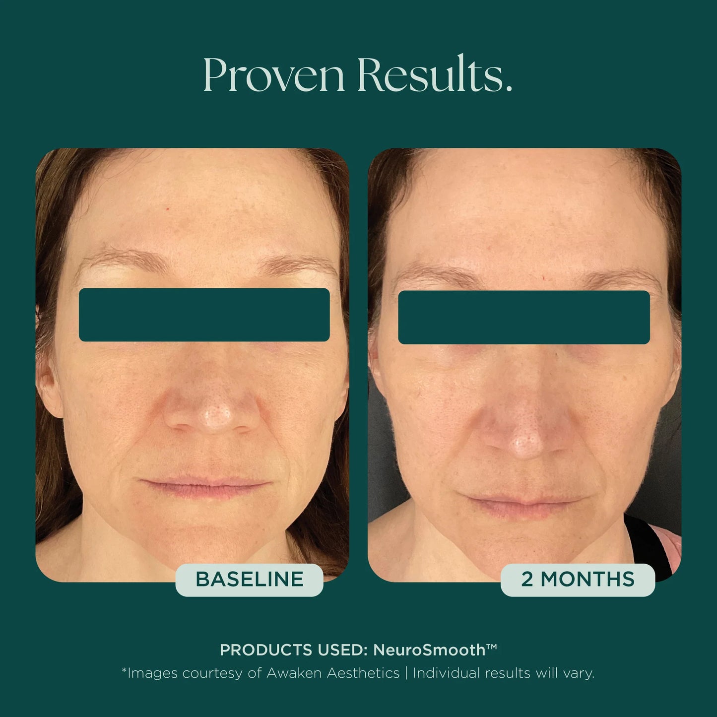 Marini SkinSolutions - NeuroSmooth (1 oz)