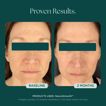 Marini SkinSolutions - NeuroSmooth (1 oz)