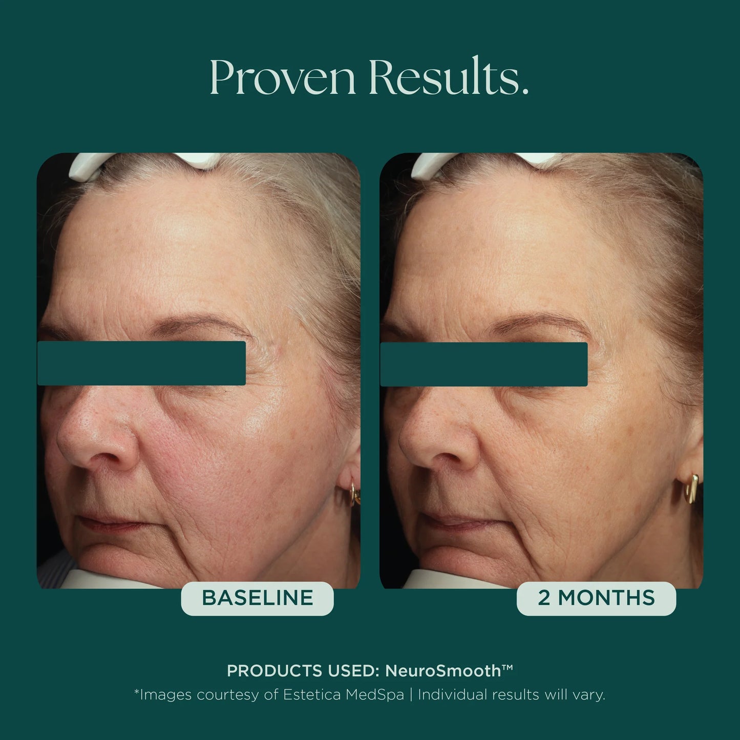 Marini SkinSolutions - NeuroSmooth (1 oz)