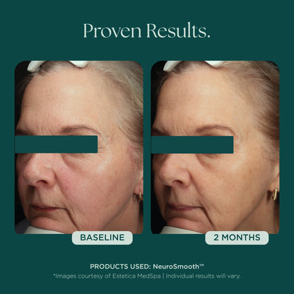 Marini SkinSolutions - NeuroSmooth (1 oz)