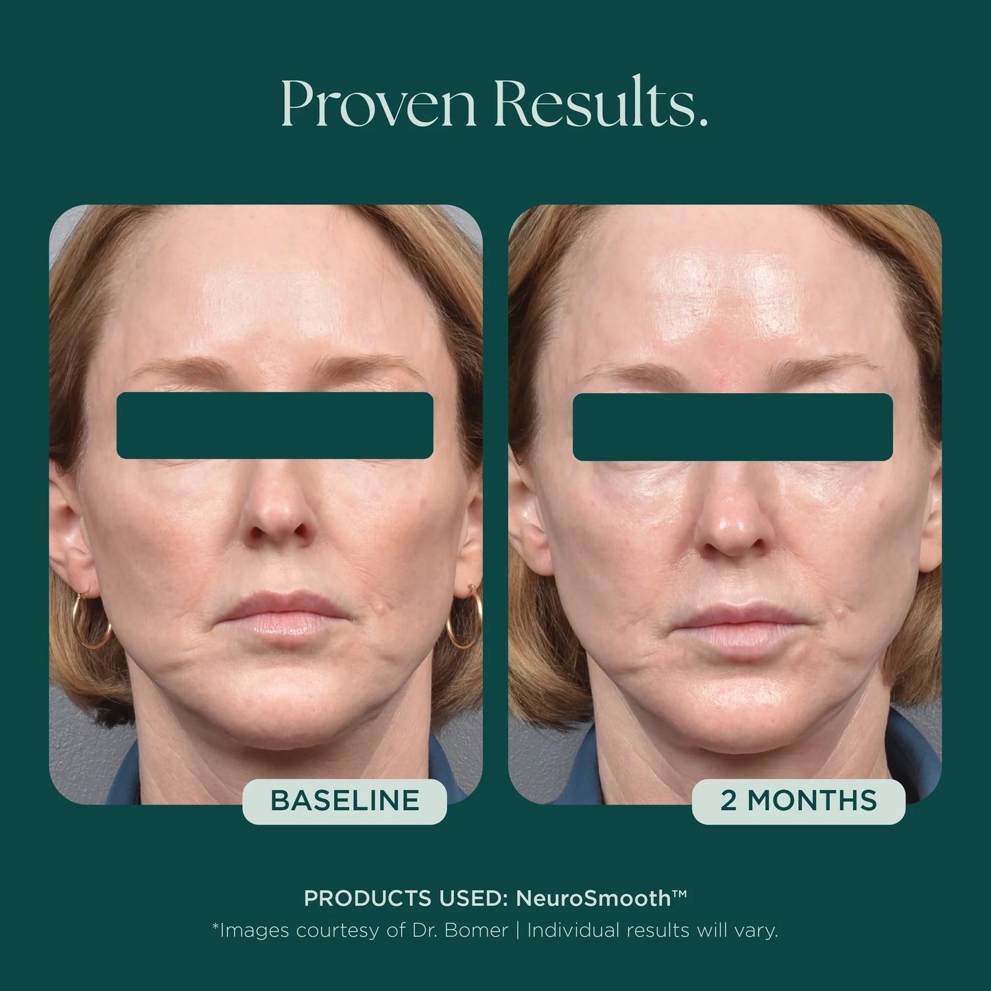 Marini SkinSolutions - NeuroSmooth (1 oz)