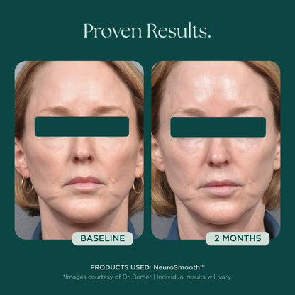 Marini SkinSolutions - NeuroSmooth (1 oz)
