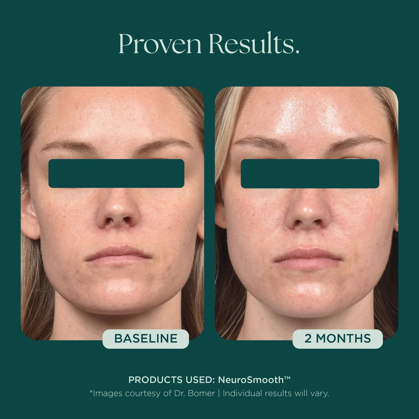 Marini SkinSolutions - NeuroSmooth (1 oz)