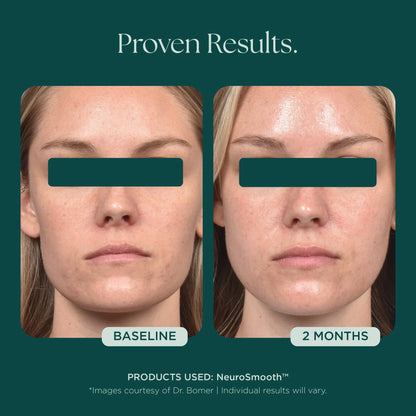 Marini SkinSolutions - NeuroSmooth (1 oz)