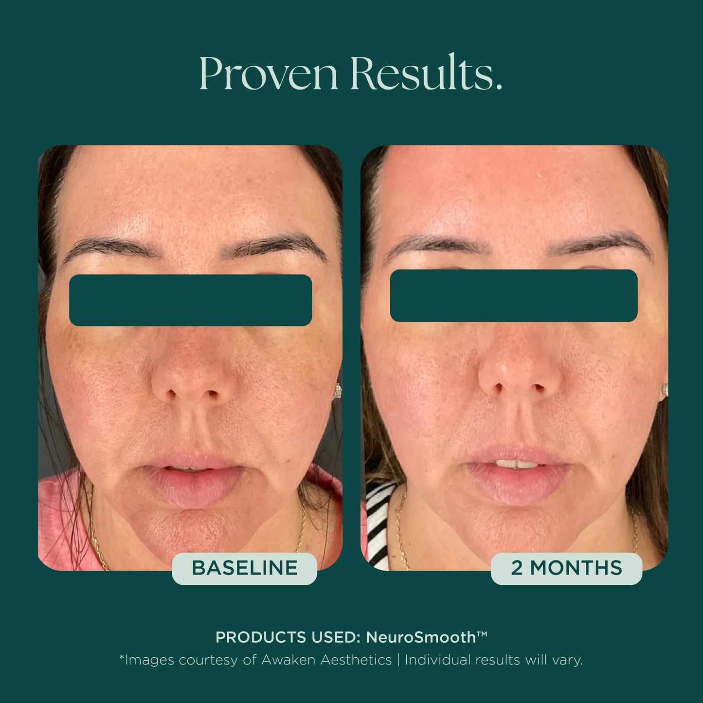 Marini SkinSolutions - NeuroSmooth (1 oz)