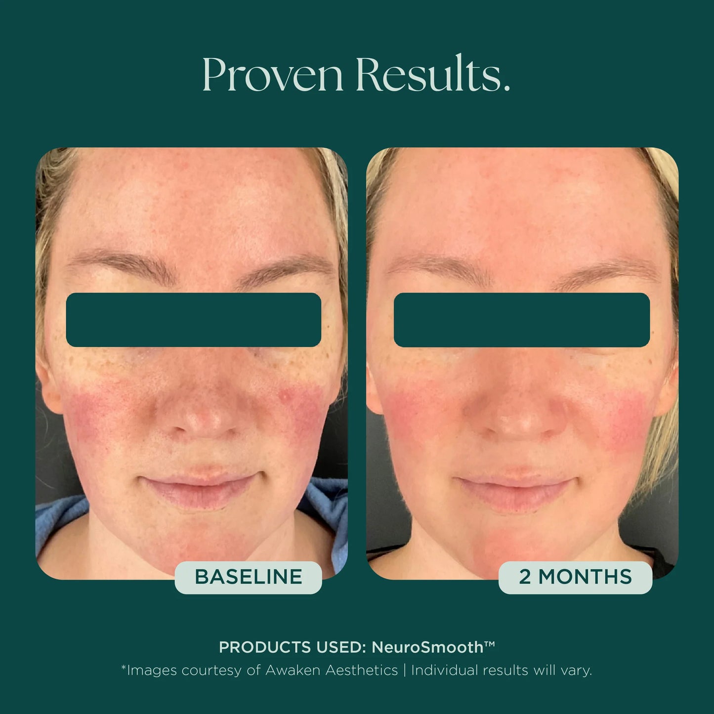 Marini SkinSolutions - NeuroSmooth (1 oz)