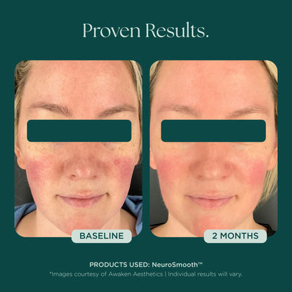 Marini SkinSolutions - NeuroSmooth (1 oz)
