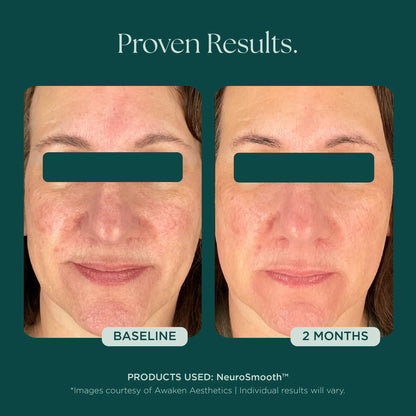 Marini SkinSolutions - NeuroSmooth (1 oz)