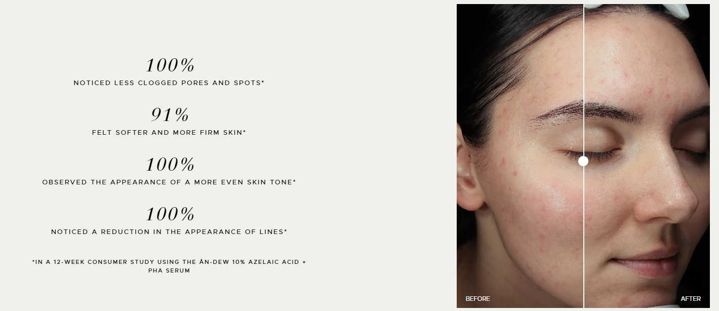 ANFISA SKIN - ÂN-DEW 10% Azelaic Acid + PHA Serum (1.7 oz) - Available in Deluxe Travel Size