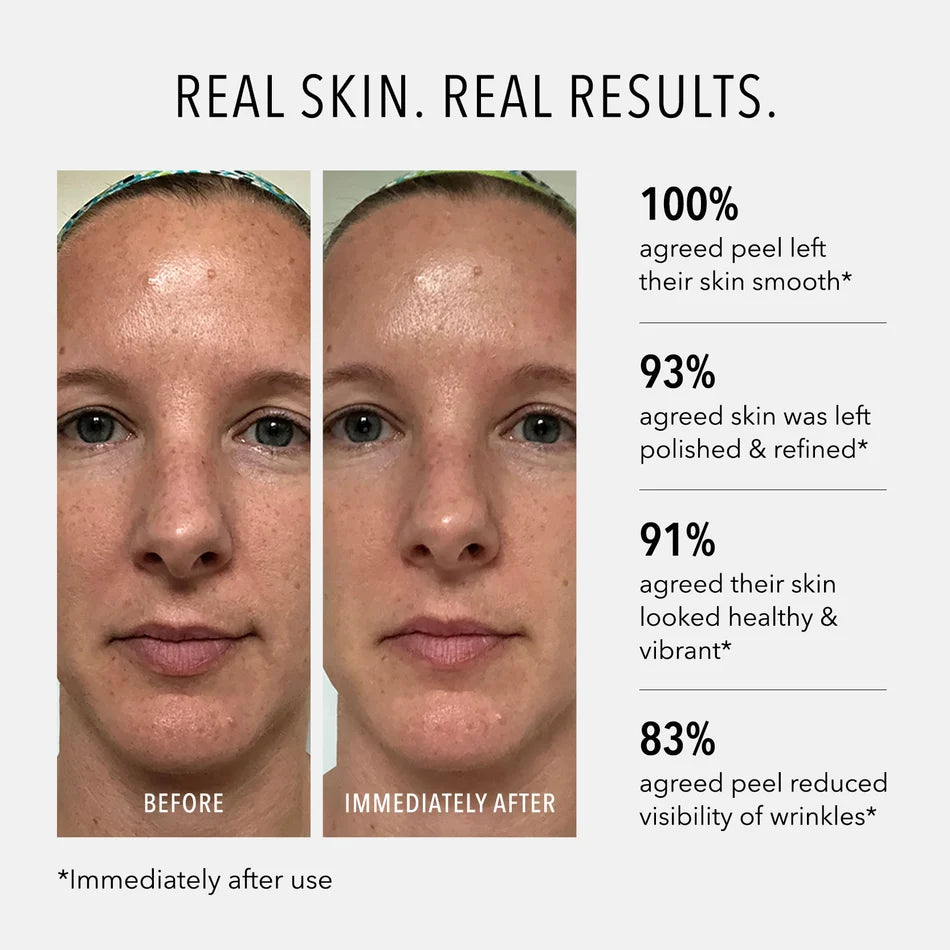 HydroPeptide® Polish & Plump Face Peel (2 Step System)