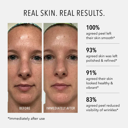 HydroPeptide® Polish & Plump Face Peel (2 Step System)