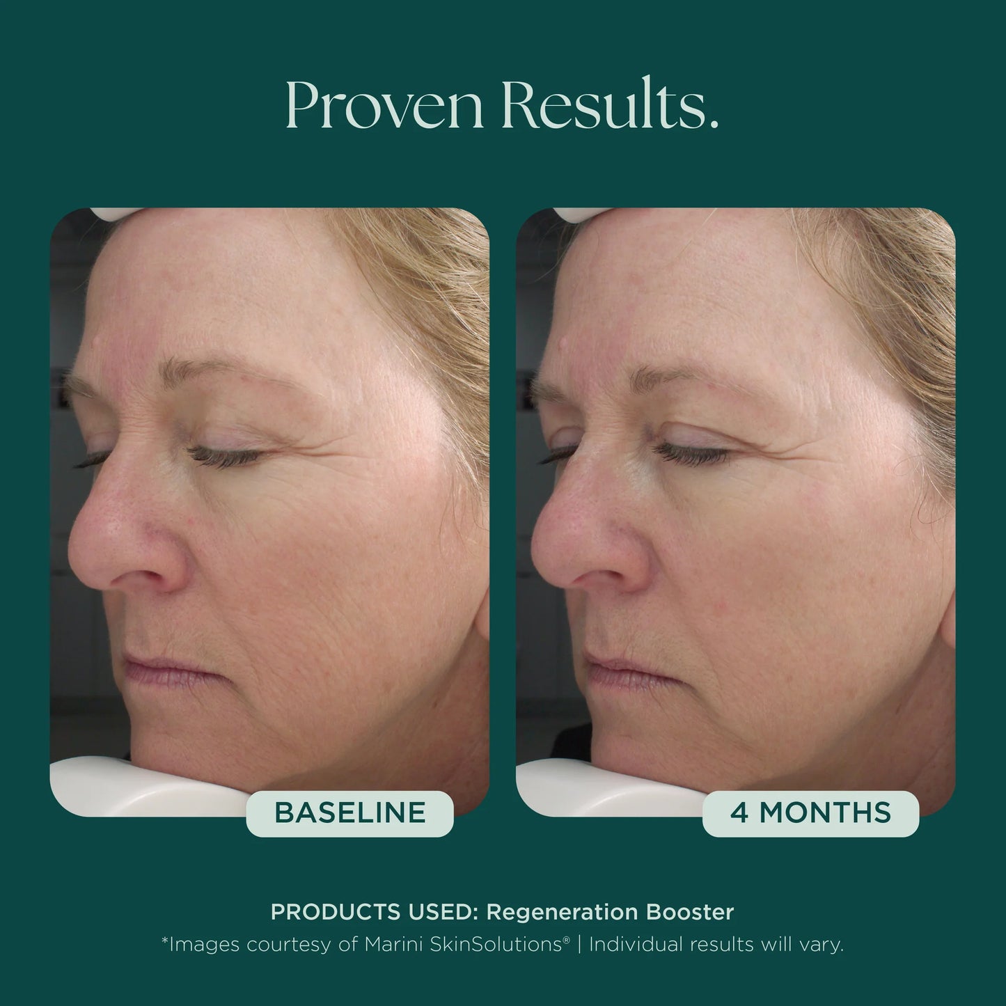 Marini SkinSolutions - Regeneration Booster (1 oz)
