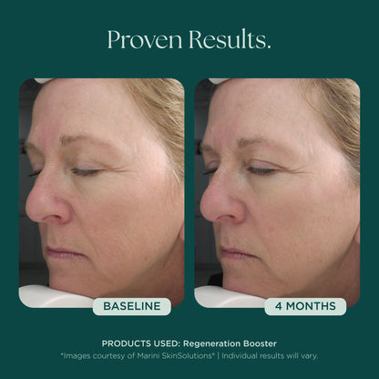 Marini SkinSolutions - Regeneration Booster (1 oz)
