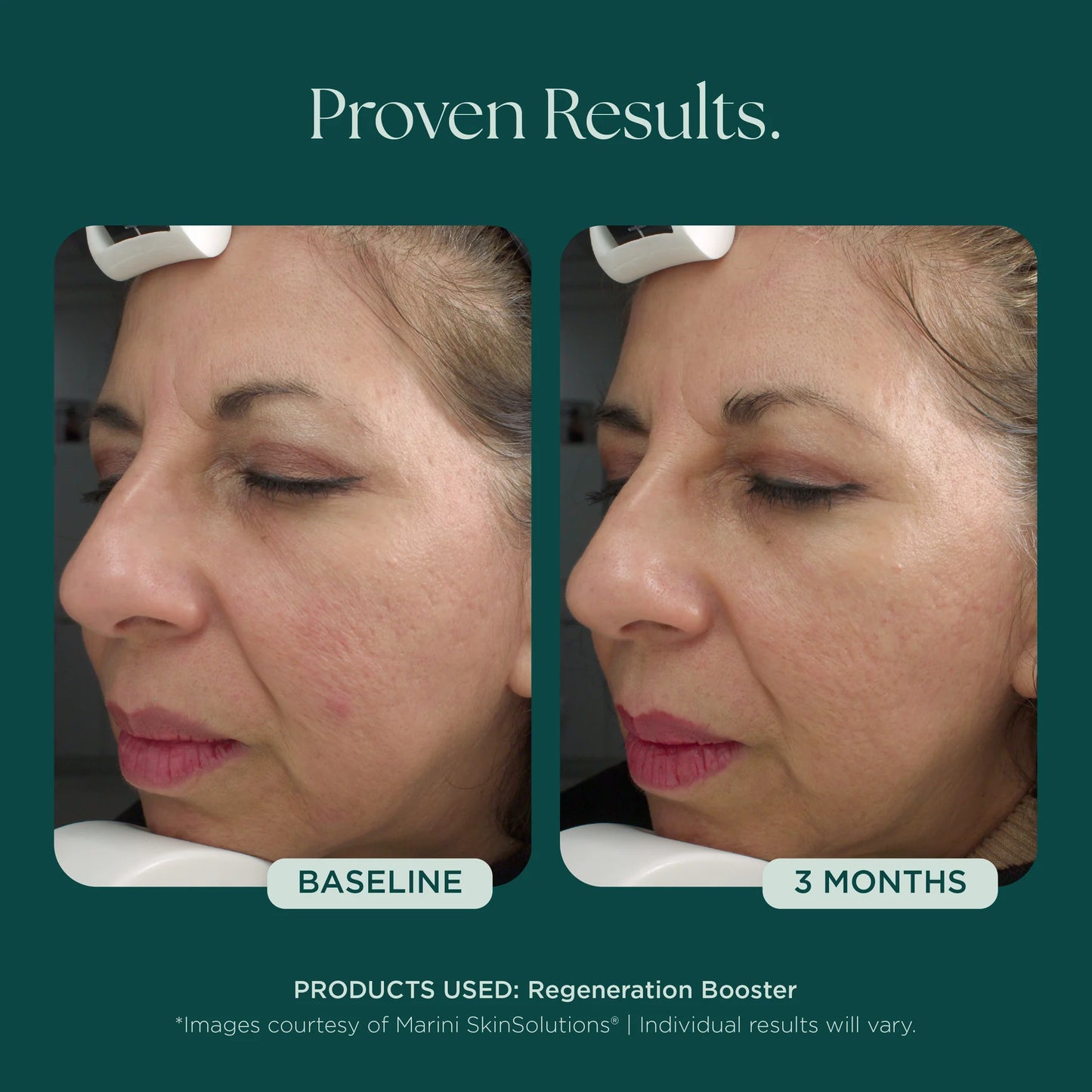 Marini SkinSolutions - Regeneration Booster (1 oz)