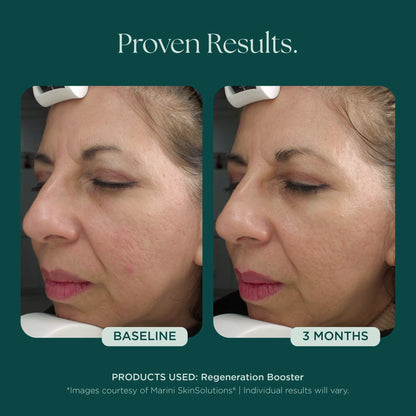 Marini SkinSolutions - Regeneration Booster (1 oz)