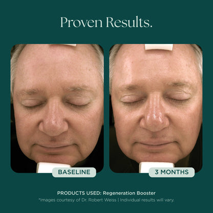 Marini SkinSolutions - Regeneration Booster (1 oz)