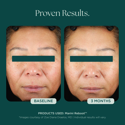 Marini SkinSolutions - Marini Reboot® PDRN Face Serum (1 oz)